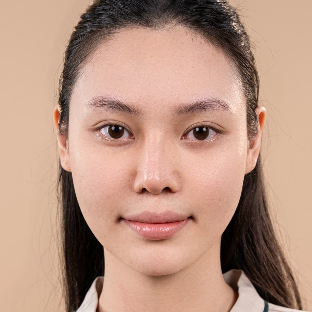 Pacientka Lưu Phương Anh - stav před zákrokem nosu One fit