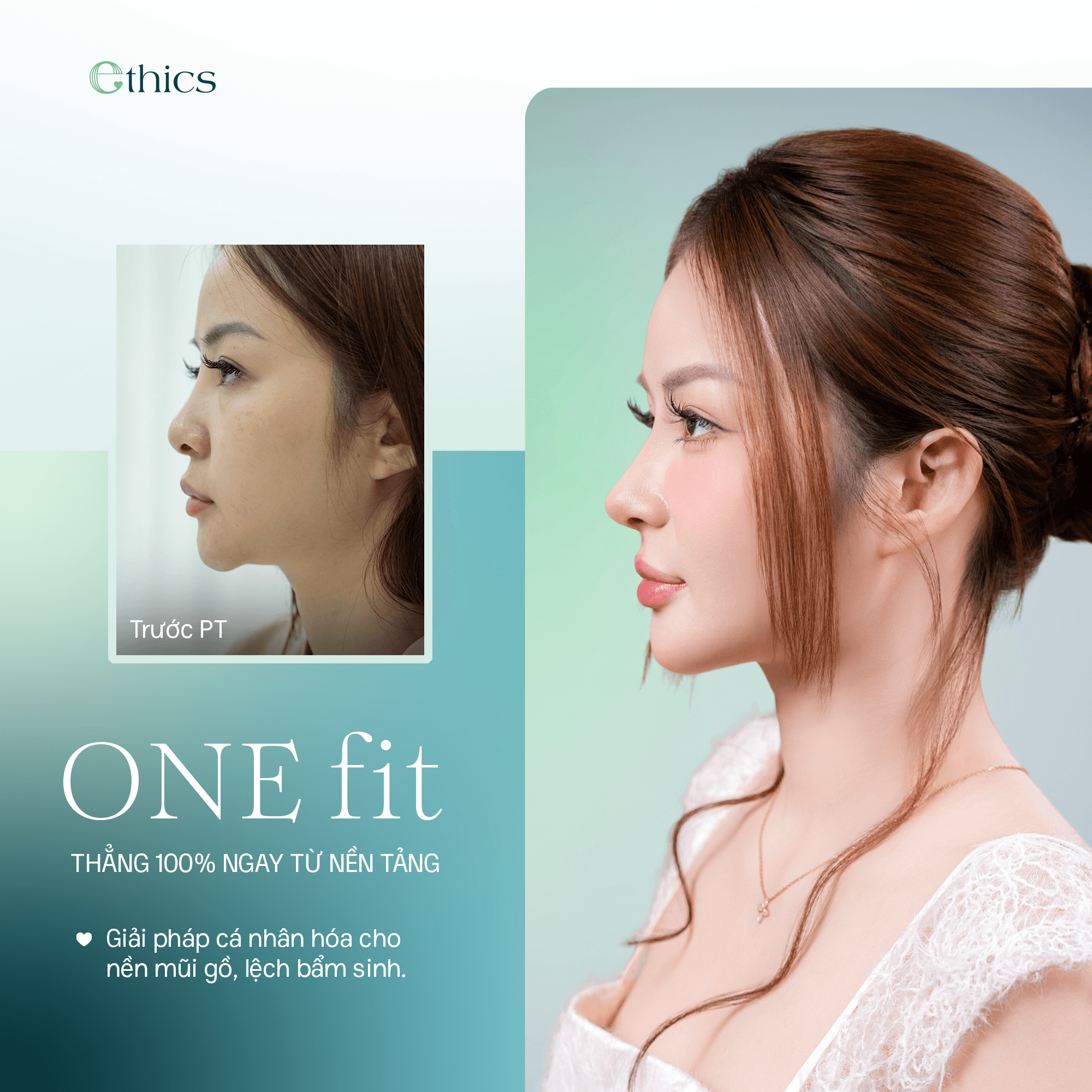 Nosní implantát OneFit Premium